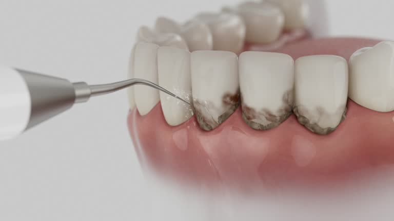 Reliable Dental contractor in Granville, OH by Dentist Open Now